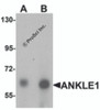 Western blot analysis of ANKLE1 in 293 cell lysate with ANKLE1 antibody at (A) 1 and (B) 2 &#956;g/mL.