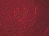 Immunofluorescence of SIK3 in rat brain cells with SIK3 antibody at 20 ug/mL.