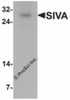 Western blot analysis of SIVA in mouse liver tissue lysate with SIVA antibody at 1 &#956;g/mL.
