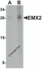 Western blot analysis of EMX2 in human lung tissue lysate with EMX2 antibody at (A) 1 and (B) 2 &#956;g/mL.