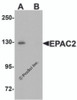 Western blot analysis of EPAC2 in rat liver tissue lysate with EPAC2 antibody at 1 &#956;g/mL in (A) the absence and (B) the presence of blocking peptide.