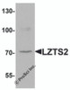 Western blot analysis of LZTS2 in human kidney tissue lysate with LZTS2 antibody at 1 &#956;g/mL.