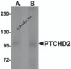 Western blot analysis of PTCHD2 in mouse kidney tissue lysate with PTCHD2 antibody at (A) 1 and (B) 2 &#956;g/mL.