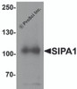 Western blot analysis of SIPA1 in human brain tissue lysate with SIPA1 antibody at 1 &#956;g/mL.