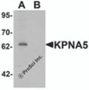 Western blot analysis of KPNA6 in EL4 cell lysate with KPNA5 antibody at 1 &#956;g/mL in (A) the absence and (B) the presence of blocking peptide.