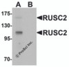 Western blot analysis of RUSC2 in SK-N-SH cell lysate with RUSC2 antibody at 1 &#956;g/mL in (A) the absence and (B) the presence of blocking peptide