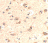 Immunohistochemistry of RUSC2 in human brain tissue with RUSC2 antibody at 5 ug/mL.