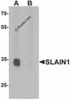 Western blot analysis of SLAIN1 in A549 cell lysate with SLAIN1 antibody at 1 &#956;g/mL in (A) the absence and (B) the presence of blocking peptide.