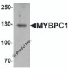 Western blot analysis of MYBPC1 in rat skeletal muscle tissue lysate with MYBPC1 antibody at 1 &#956;g/mL.