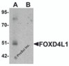 Western blot analysis of FOXD4L1 in A-20 cell lysate with FOXD4L1 antibody at 1 &#956;g/mL in (A) the absence and (B) the presence of blocking peptide.