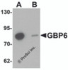 Western blot analysis of GBP6 in Hela cell lysate with GBP6 antibody at 0.5 &#956;g/mL in (A) the absence and (B) the presence of blocking peptide.