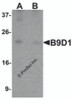 Western blot analysis of B9D1 in 293 cell lysate with B9D1 antibody at 1 &#956;g/mL in (A) the absence and (B) the presence of blocking peptide.