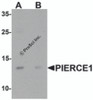 Western blot analysis of PIERCE1 in A20 cell lysate with PIERCE1 antibody at 1 &#956;g/mL in (A) the absence and (B) the presence of blocking peptide.