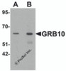 Western blot analysis of GRB10 in SK-N-SH cell lysate with GRB10 antibody at (A) 1 and (B) 2 &#956;g/mL.