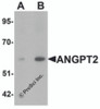 Western blot analysis of ANGPT2 in human liver tissue lysate with ANGPT2 antibody at (A) 1 and (B) 2 &#956;g/mL.