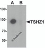 Western blot analysis of TSHZ1 in A-20 cell lysate with TSHZ1 antibody at 1 &#956;g/mL in (A) the absence and (B) the presence of blocking peptide.