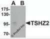 Western blot analysis of TSHZ2 in A-20 cell lysate with TSHZ2 antibody at 1 &#956;g/mL in (A) the absence and (B) the presence of blocking peptide.