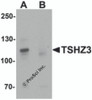 Western blot analysis of TSHZ3 in mouse brain tissue lysate with TSHZ3 antibody at 1 &#956;g/mL in (A) the absence and (B) the presence of blocking peptide.