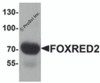 Western blot analysis of FOXRED2 in human lung tissue lysate with FOXRED2 antibody at 1 &#956;g/mL.
