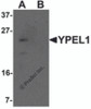 Western blot analysis of YPEL1 in Hela cell lysate with YPEL1 antibody at 1 &#956;g/mL in (A) the absence and (B) the presence of blocking peptide.