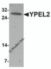 Western blot analysis of YPEL2 in HeLa cell lysate with YPEL2 antibody at 1 &#956;g/mL.