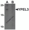 Western blot analysis of YPEL3 in A-20 cell lysate with YPEL3 antibody at 1 &#956;g/mL in (A) the absence and (B) the presence of blocking peptide