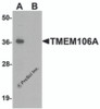 Western blot analysis of TMEM106A in A-20 cell lysate with TMEM106A antibody at 1 &#956;g/mL in (A) the absence and (B) the presence of blocking peptide.
