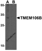 Western blot analysis of TMEM106B in human brain tissue lysate with TMEM106B antibody at 1 &#956;g/mL in (A) the absence and (B) the presence of blocking peptide.