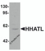 Western blot analysis of HHATL in 3T3 cell lysate with HHATL antibody at 1 &#956;g/mL.