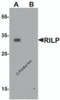 Western blot analysis of RILP in A20 cell lysate with RILP antibody at 1 &#956;g/mL.