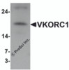 Western blot analysis of VKORC1 in A549 cell lysate with VKORC1 antibody at 1 &#956;g/mL.