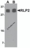 Western blot analysis of RLP2 in A549 cell lysate with RLP2 antibody at (A) 1 and (B) 2 &#956;g/mL.