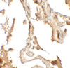 Immunohistochemistry of RLP2 in human lung tissue with RLP2 antibody at 2.5 ug/mL.