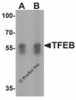 Western blot analysis of TFEB in A549 cell lysate with TFEB antibody at (A) 1 and (B) 2 &#956;g/mL.