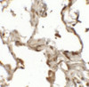 Immunohistochemistry of TFEB (NT) in human lung tissue with TFEB (NT) antibody at 2.5 ug/mL.