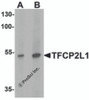 Western blot analysis of TFCP2L1 in human colon tissue lysate with TFCP2L1 antibody at (A) 1 and (B) 2 &#956;g/mL