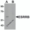 Western blot analysis of ESRRB in human heart tissue lysate with ESRRB antibody at 1 &#956;g/mL in (A) the absence and (B) the presence of blocking peptide.
