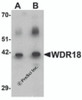 Western blot analysis of WDR18 in rat lung tissue lysate with WDR18 antibody at (A) 1 and (B) 2 &#956;g/mL.