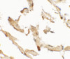 Immunohistochemistry of WDR18 in human lung tissue with WDR18 antibody at 2.5 ug/mL.