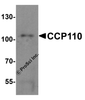 Western blot analysis of CCP110 in human colon tissue lysate with CCP110 antibody at 1 &#956;g/mL.
