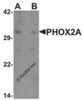 Western blot analysis of PHOX2A in rat brain tissue lysate with PHOX2A antibody at 1 &#956;g/ml in (A) the absence and (B) the presence of blocking peptide.