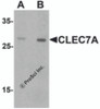 Western blot analysis of CLEC7A in rat spleen tissue lysate with CLEC7A antibody at (A) 1 and (B) 2 &#956;g/mL.