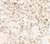 Immunohistochemistry of CLEC7A in human spleen tissue with CLEC7A antibody at 5 ug/mL.