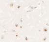 Immunohistochemistry of SHANK3 in human brain tissue with SHANK3 antibody at 2.5 ug/mL.