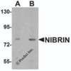 Western blot analysis of NIBRIN in rat lung tissue lysate with NIBRIN antibody at (A) 1 and (B) 2 &#956;g/mL.