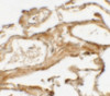 Immunohistochemistry of NIBRIN (NT) in human lung tissue with NIBRIN (NT) antibody at 2.5 ug/mL.