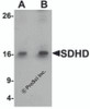 Western blot analysis of SDHD in EL4 cell lysate with SDHD antibody at (A) 1 and (B) 2 &#956;g/mL.