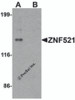 Western blot analysis of ZNF521 in HeLa cell lysate with ZNF521 antibody at 1 &#956;g/ml in (A) the absence and (B) the presence of blocking peptide.