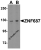 Western blot analysis of ZNF687 in HeLa cell lysate with ZNF687 antibody at (A) 1 and (B) 2 &#956;g/mL.