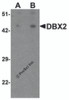 Western blot analysis of WDR18 in rat lung tissue lysate with WDR18 antibody at (A) 1 and (B) 2 &#956;g/mL.